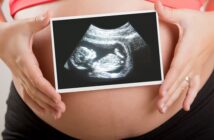 Schwangerschaft Ultraschall: Wieviele Untersuchungen sind es?